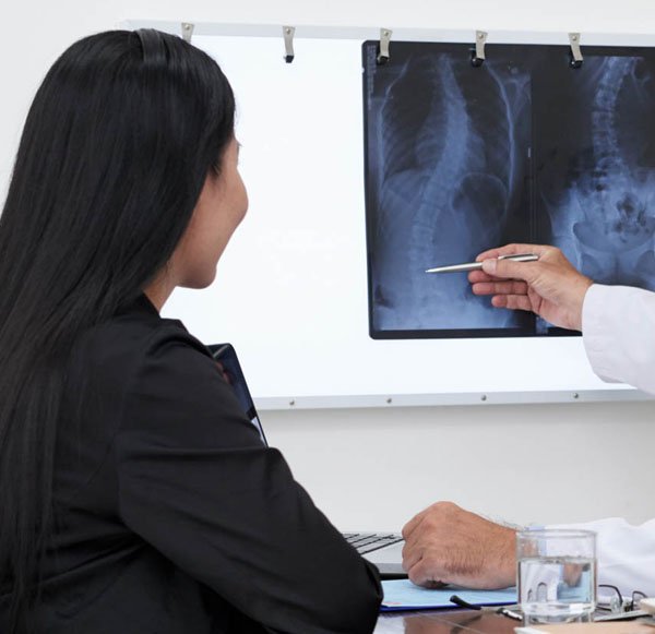 Κύφωση - Σκολίωση