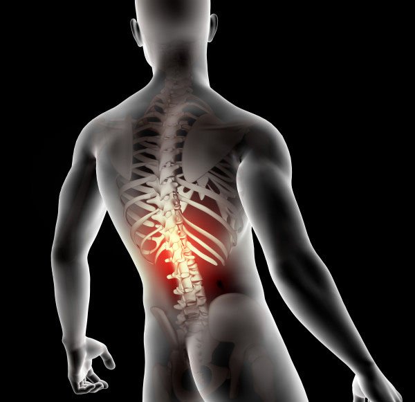 Οσφυαλγία